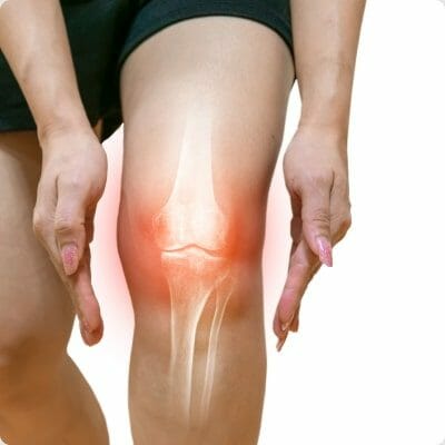 Collagen for bones and joints