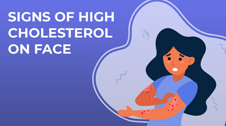 Signs of high cholesterol on face