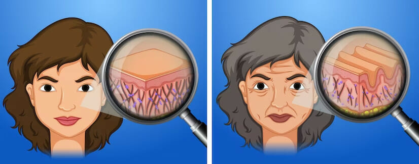 Prevent Sagging skin with best collagen for older women